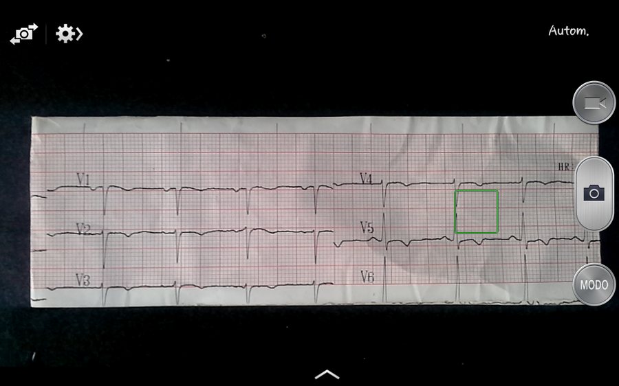 The app's camera capture screen framing an ECG strip
