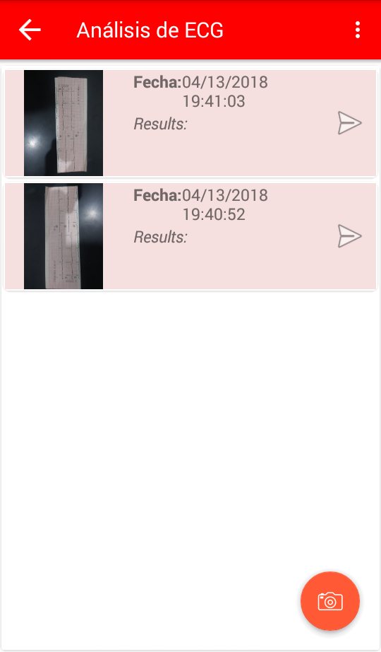 The app's list of previously submitted ECG exams with their processing status and date