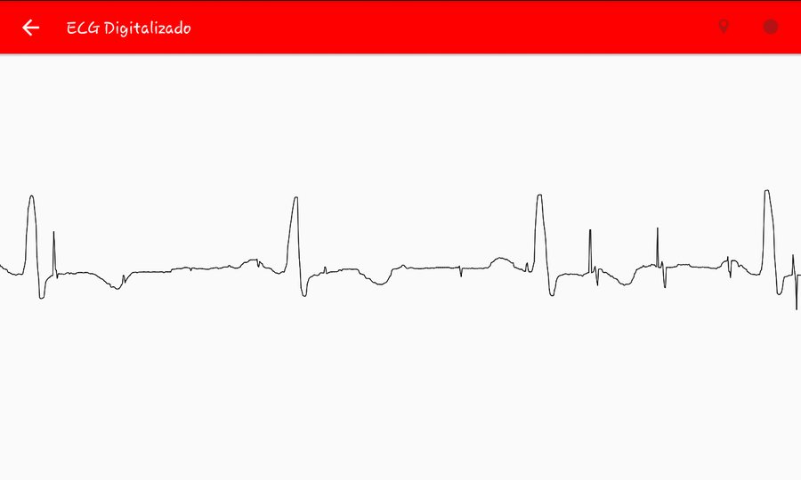 The app's results screen showing a zoomable, pannable chart of the digitized ECG signal