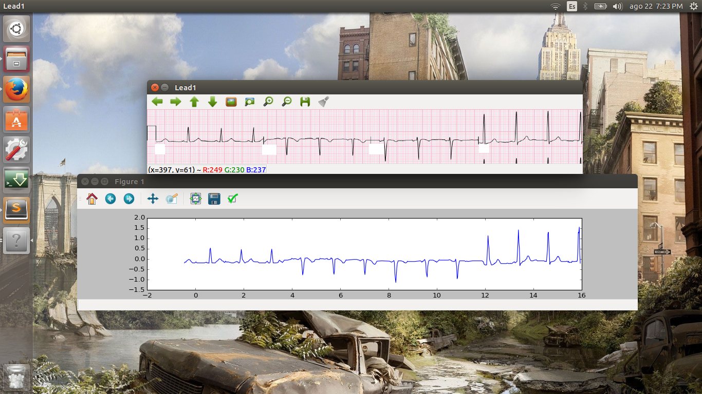 A development screenshot: the pipeline's OpenCV debug viewer and a Matplotlib figure showing the same digitized ECG lead side by side