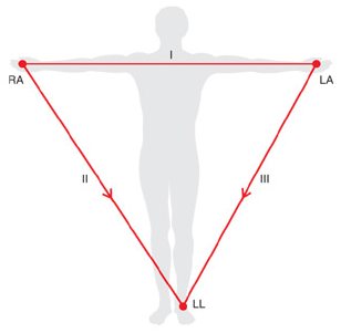 Einthoven's triangle: the three bipolar limb leads I, II, III formed between the right arm, left arm and left leg